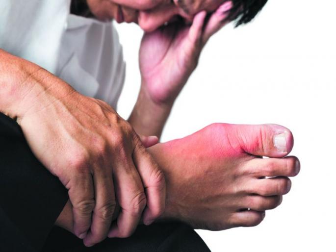 यूरिक एसिड बढ़ने पर अपनाएं इन घरेलू नुस्खों को, जोड़ों के दर्द में मिलेगा आराम