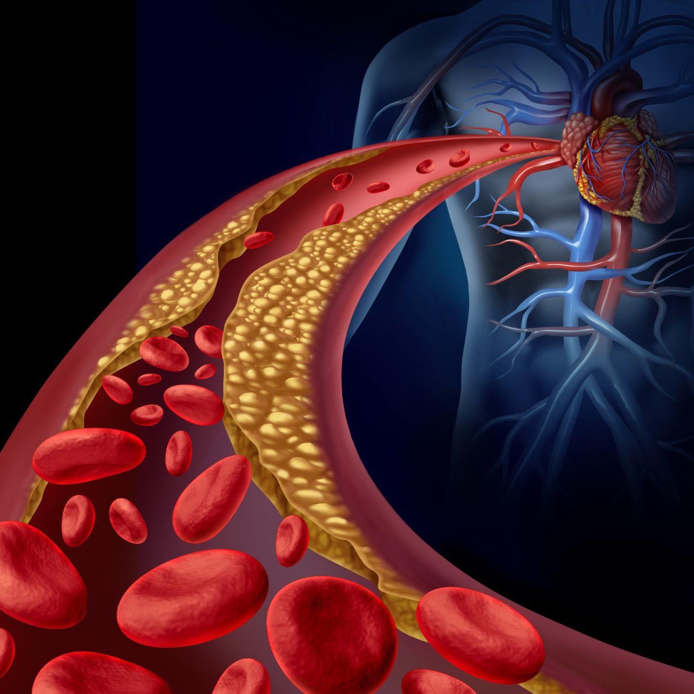 किचन में रखी ये 2 चीज़ें कण्ट्रोल करेंगी आपका हाई कोलेस्ट्रॉल (High Cholesterol)