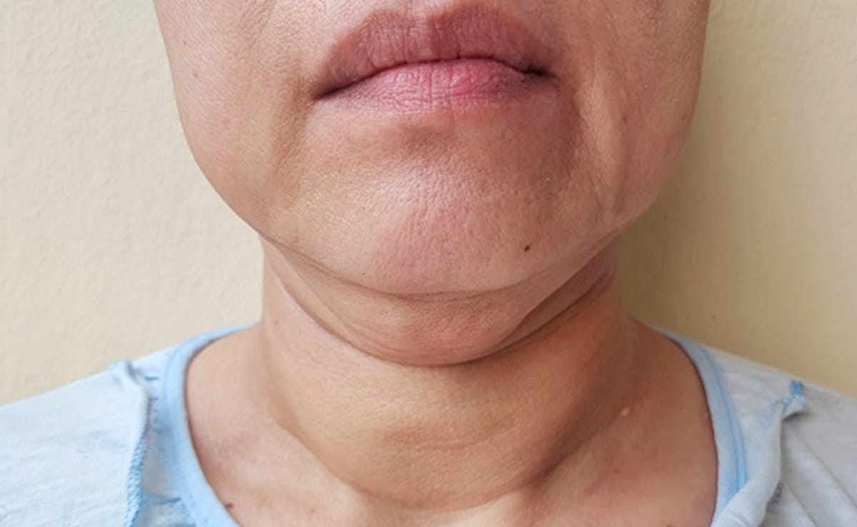 Skin Care Tips : चहरे की फाइन लाइंस को गायब करेंगी ये 5 चीज़ें