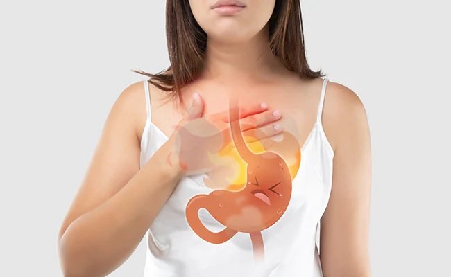 Acidity Home Remedy : इन चीज़ों को खाने से मिलेगी एसिडिटी से राहत