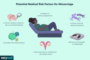 Causes of Miscarriage